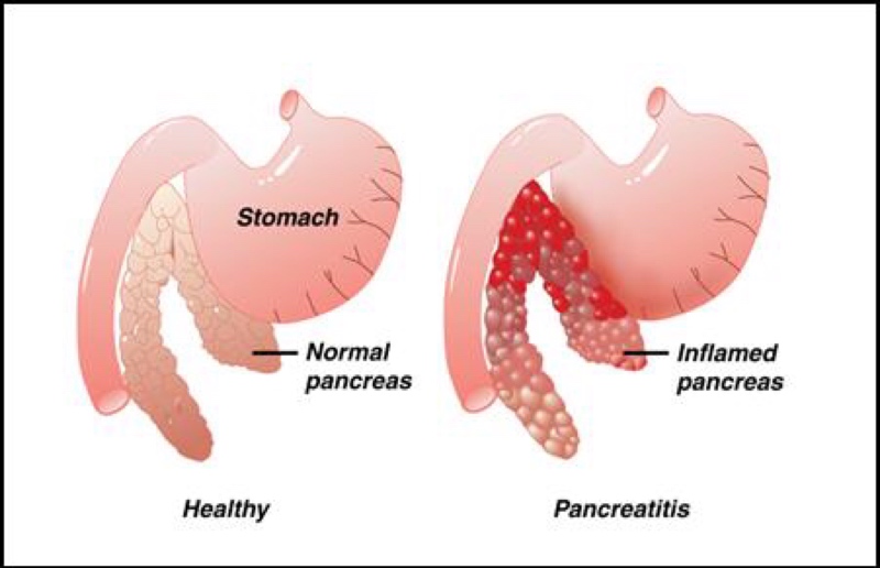 pancreatitis in dogs